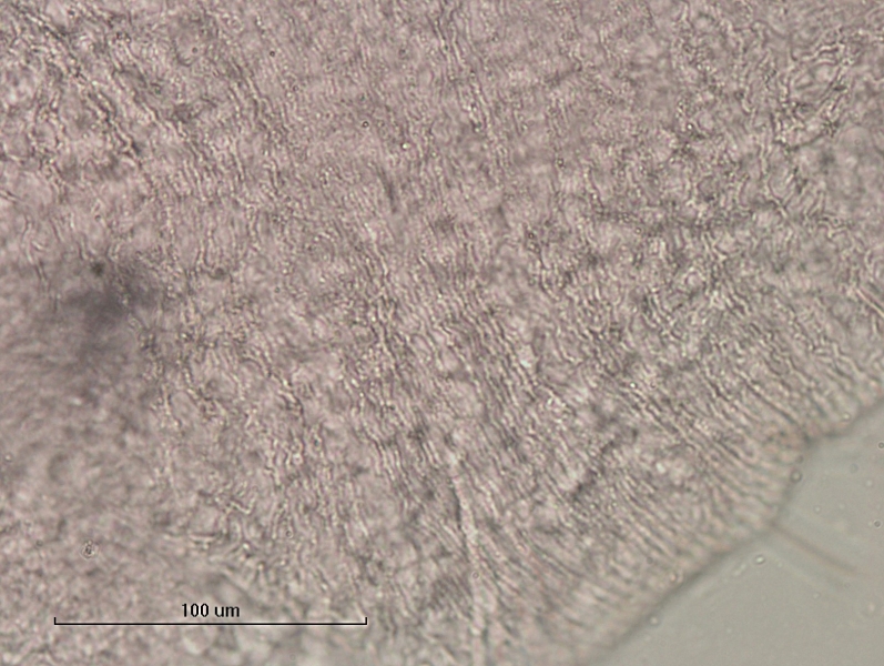 photomicrograph of part of a freshwater oligochaete worm showing the texture of the skin, which has rows of lines around the segments giving it a wrinkled appearance.