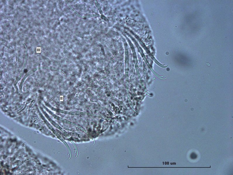 photomicrograph of the head of a freshwater oligochaete worm showing segments II and III, II has bundles of 4 chaetae with the upper tooth 2x long as the lower tooth, and III has 2 chaetae of the same type