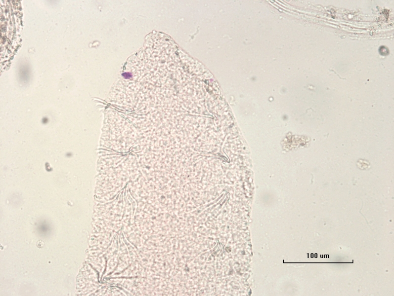 photomicrograph of the head of a freshwater oligochaete worm with eyes, showing the first five or so segments, scale 100 um