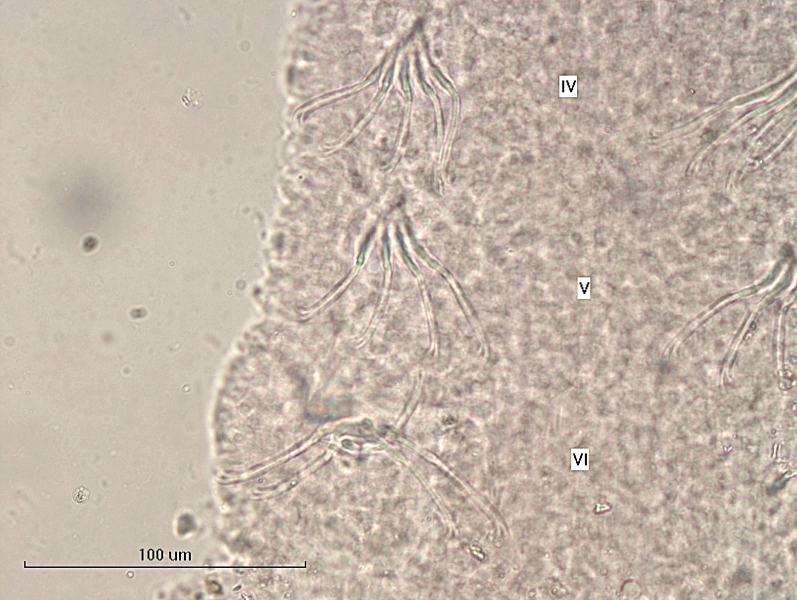 photomicrograph of part of a freshwater oligochaete worm showing segments IV, V and VI, which each have 4 or 5 bifid chaetae per bundle which do not change shape, scale 100 um