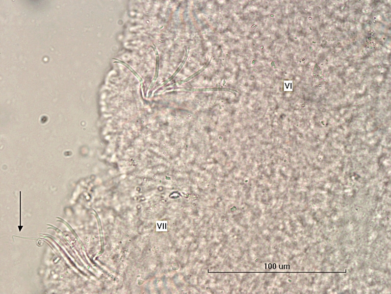 photomicrograph of part of a freshwater oligochaete worm showing segments VI and VII, which each have 4 or 5 bifid chaetae, and only VII also has a short faint hair, scale 100 um