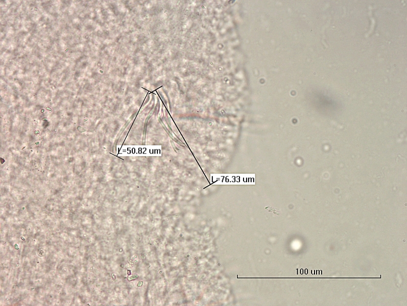 photomicrograph of part of a freshwater oligochaete worm showing a bundle of 4 bifid chaetae and one short hair, bifid chaetae measure 50.82 um and hair measures 76.33 um. Scale 100 um