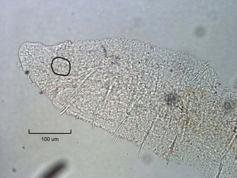 photomicrograph of the head of a freshwater oligochaete worm, showing the first seven or so segments, scale 100 um. Within a drawn circle is a very small, faint pink dot.