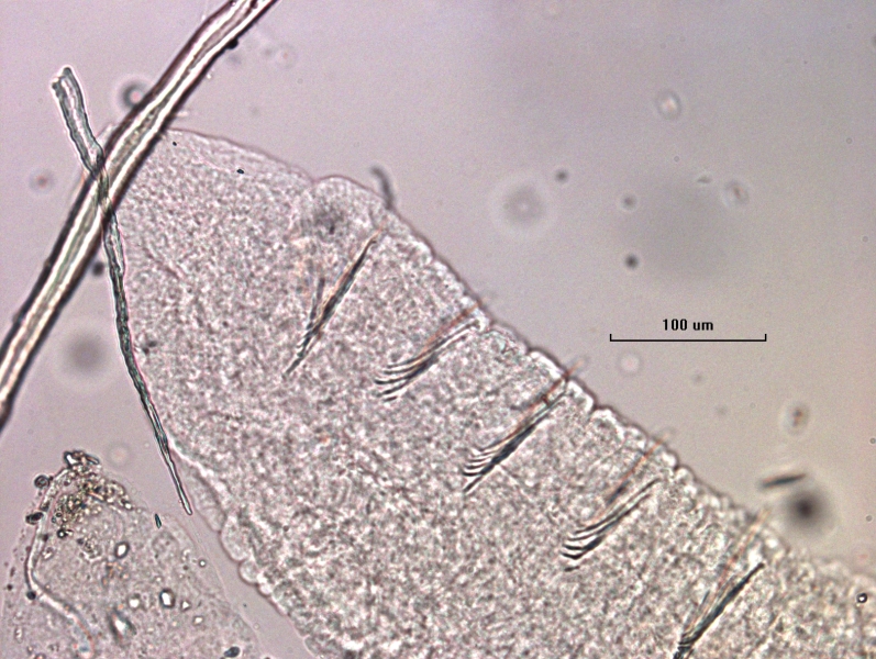 photomicrograph of the head of a freshwater oligochaete worm that lacks eyes and only has ventral chaetae in the first 5 or so segments. Scale 100 um