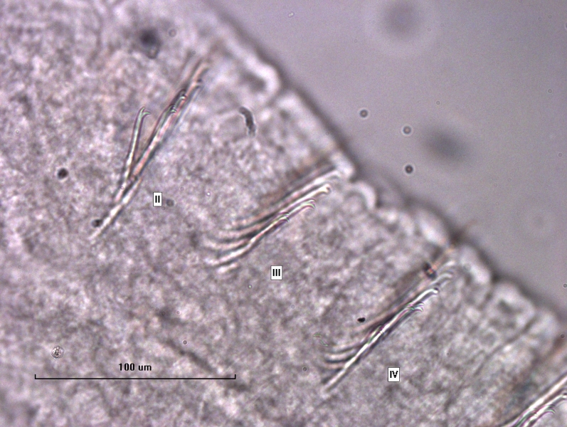 photomicrograph of part of a freshwater oligochaete worm showing segments II, III, and IV. The bifid chaetae are divergent with the upper tooth shorter than the lower tooth. Scale 100 um