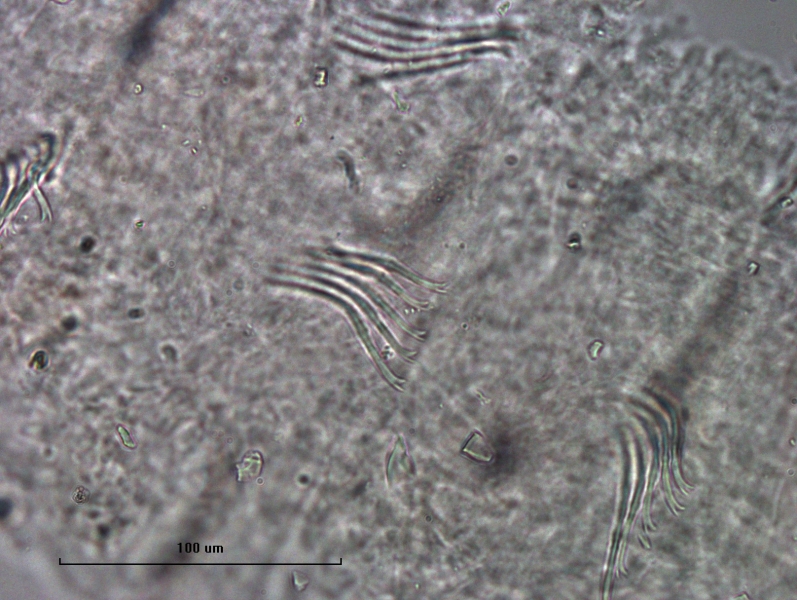 photomicrograph of part of a freshwater oligochaete worm showing several bundles of about 5 bifid chaetae with divergent teeth. Scale 100 um