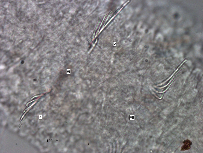 photomicrograph of part of a freshwater oligochaete worm showing segments VI and VII, each with two sets of 4-6 bifid chaetae although one is labeled v and one is d. Scale 100 um