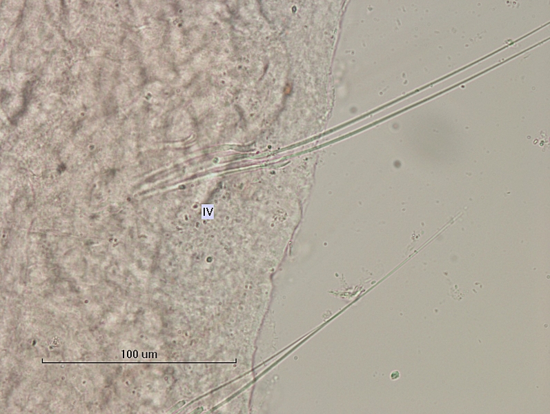photomicrograph of part of a freshwater oligochaete worm showing a bundle labeled VI with 2 hairs and 3 pectinate chaetae. Scale 100 um