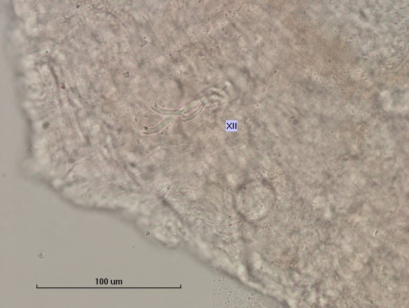 photomicrograph of part of a freshwater oligochaete worm showing a segment labeled XII with 3 bifid chaetae with teeth of equal length, but the upper tooth is much thinner than the lower tooth. Scale 100 um