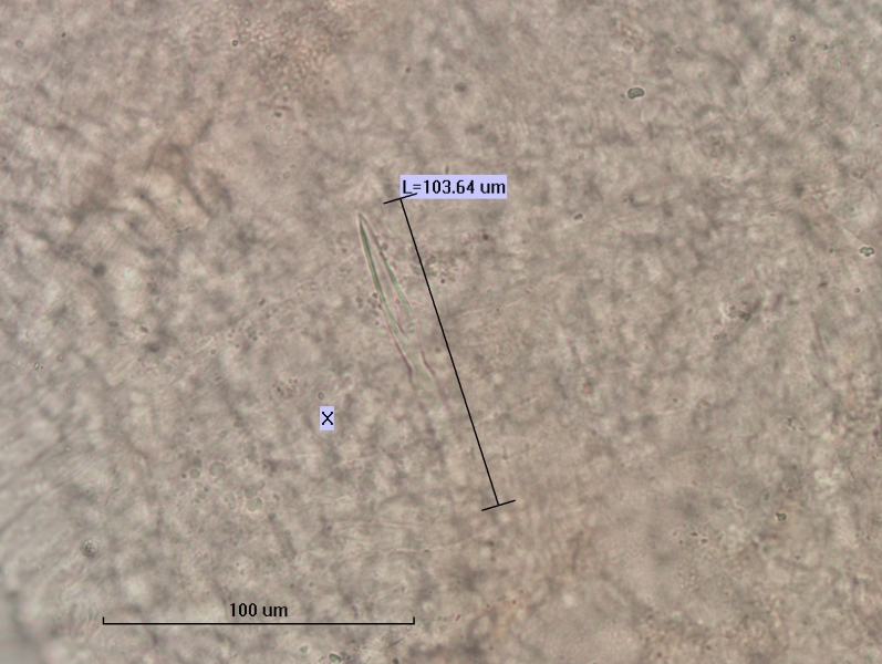 photomicrograph of part of a freshwater oligochaete worm showing a segment labeled X with a needle-shaped reproductive chaetae with parallel sides and a narrow trough. Chaetae measures 103.64 um, scale 100 um