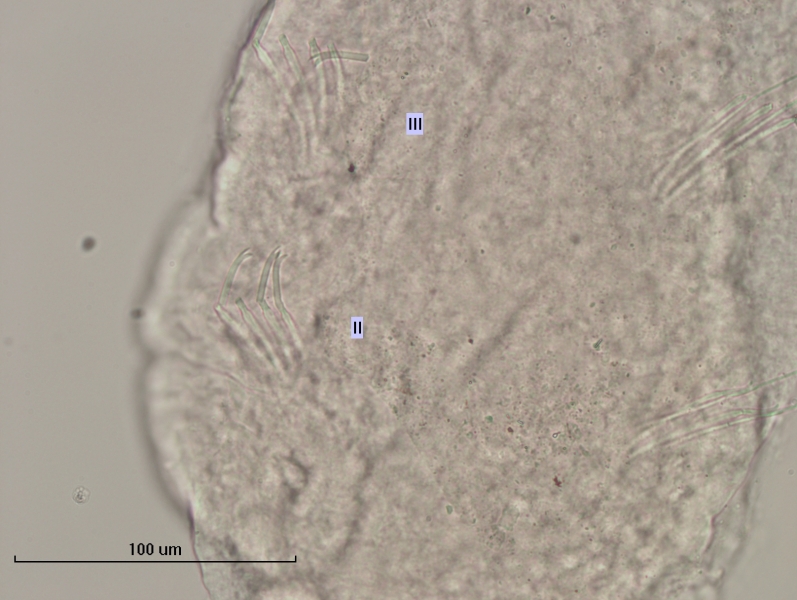 photomicrograph of part of a freshwater oligochaete worm showing two segments II and III with about 5 bifid chaetae with teeth of equal length, although several are broken. Scale 100 um