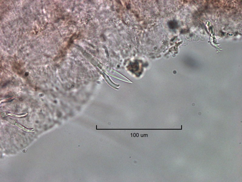 photomicrograph of part of a freshwater oligochaete worm showing a bundle with a bifid chaetae and a needle-shaped reproductive chaetae with a narrow trough between two slightly curved sides. Scale 100 um