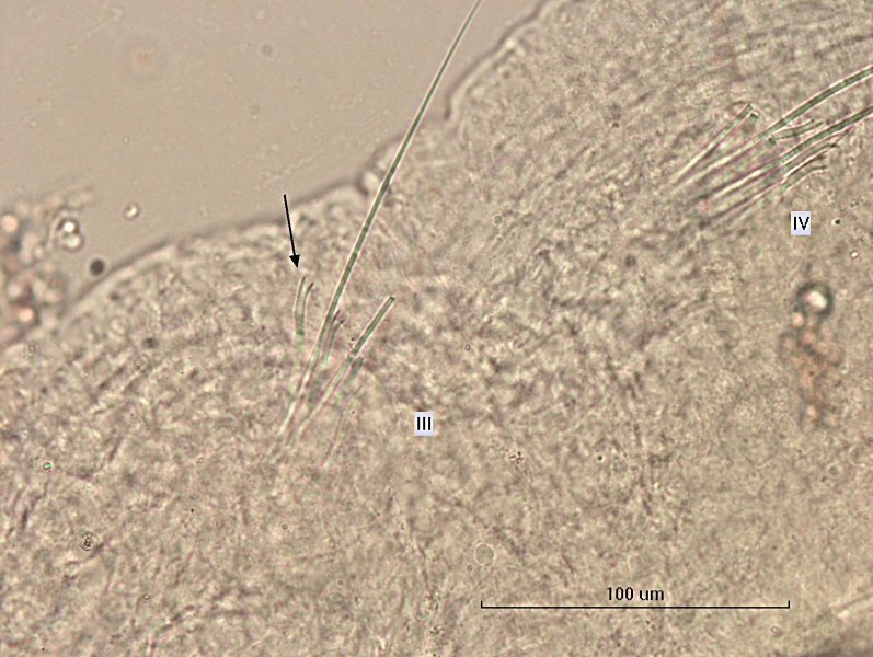 photomicrograph of part of a freshwater oligochaete worm showing bundles of chaetae and hairs in segments III and IV. There are two or more hairs per bundle with forked chaetae with two tines and maybe some very hard to see intermediate teeth. Scale bar 100 um.