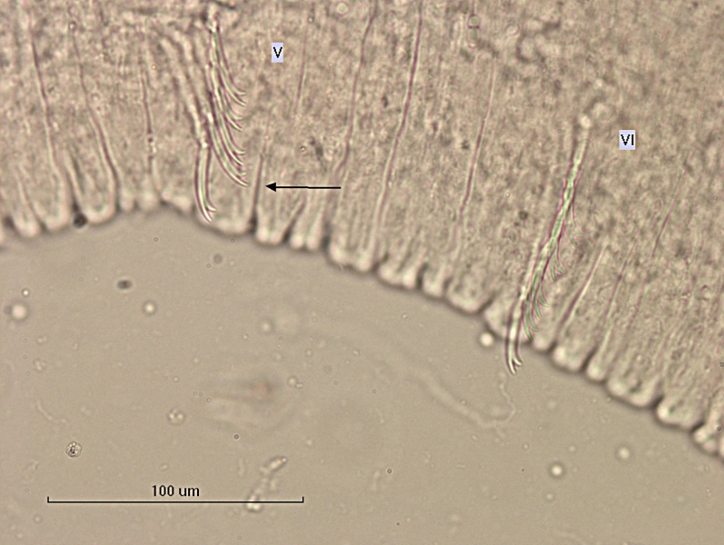 photomicrograph of part of a freshwater oligochaete worm showing bundles of chaetae in segments V and VI. There are five chaetae per bundle, slightly curved with two teeth at the end with the upper tooth as long as or longer than the lower tooth. Scale bar 100 um.