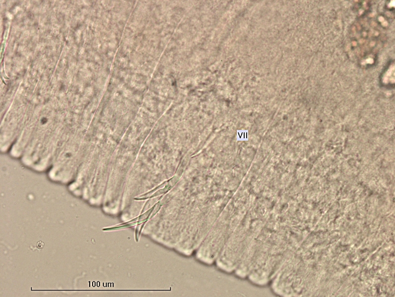 photomicrograph of part of a freshwater oligochaete worm showing a bundle of specialized chaetae in segment VII. There are three curled blade-shaped chaetae with two sides that taper to a point. Scale bar 100 um.