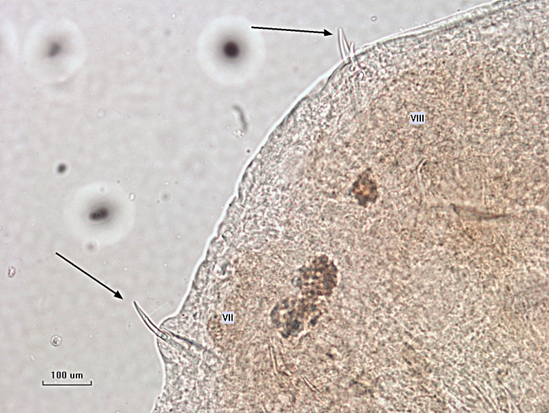 photomicrograph of part of a freshwater oligochaete worm showing two bundles of specialized chaetae in segment VII and VIII. There are one or two blade-shaped chaetae with two sides that taper to a point sticking out of the body of the worm. Scale bar 100 um.