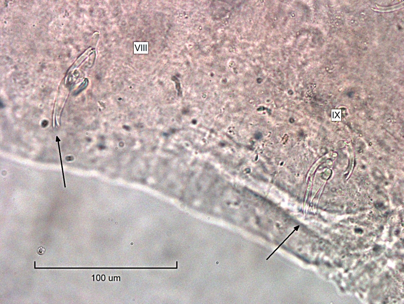 photomicrograph of part of a freshwater oligochaete worm showing two bundles of specialized chaetae in segment VIII and IX. There are two bifid chaetae and two blade-shaped chaetae with two sides that taper to a point in IX and there is a very wide bifid chaetae in VIII that is a mix between the two types. Scale bar 100 um.