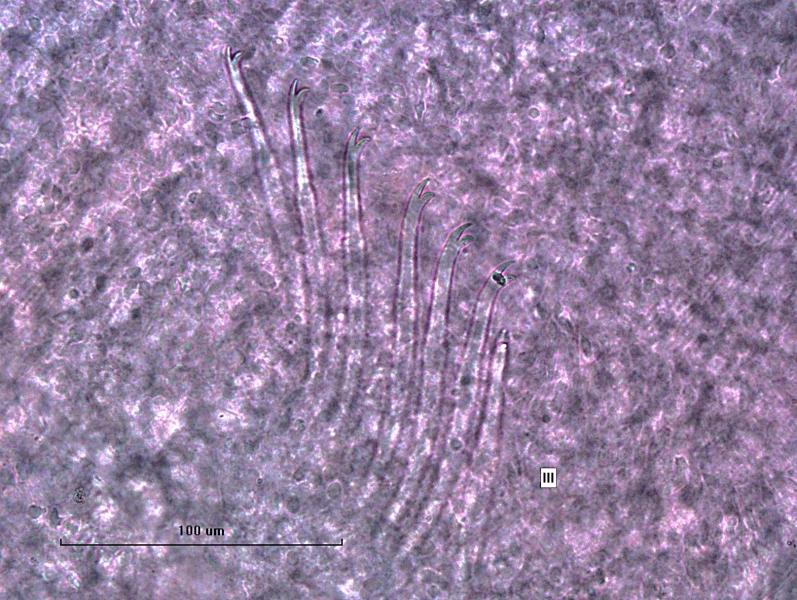 Photomicrograph of a bundle of worm somatic hairs (chaetae) with bifid ends, the upper tooth is slightly longer and thinner than the lower
