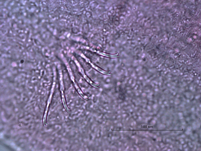 Photomicrograph of a bundle of worm somatic hairs (chaetae) with bifid ends, the upper tooth is slightly longer and thinner than the lower, but generally short.