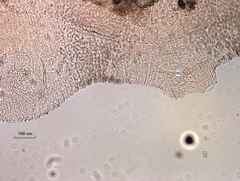 Photomicrograph of part of a worm showing reproductive structures. In a segment labeled X, a modified spear-shaped somatic hair (chaeta) sits near a pore, and the next segment XI has a short pene sticking out of the body, with a bump with a single bifid chaeta.