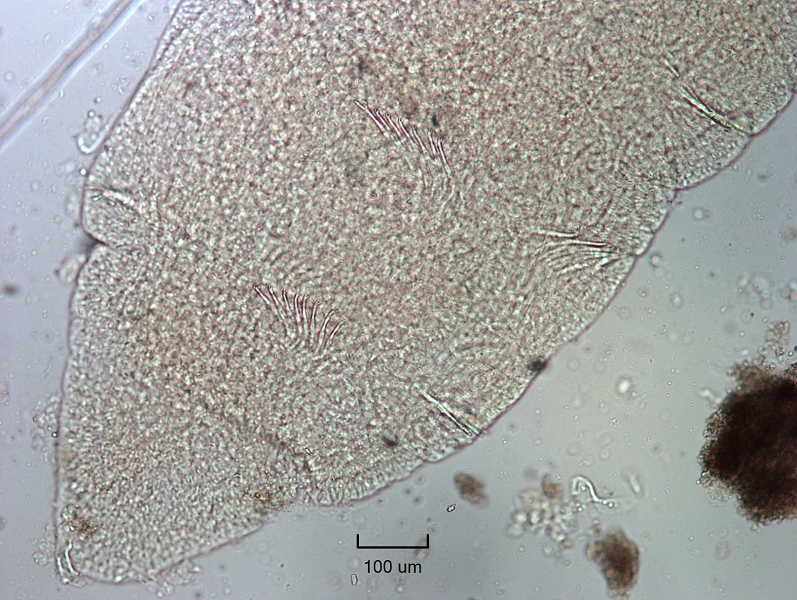 Photomicrograph of the head of  worm with bundles of somatic hairs (chaetae) with bifid ends