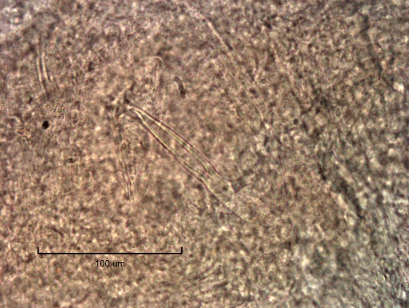Photomicrograph of a part of a worm showing a specialized chaetae that is spear-shaped with a hollow depression in between the sides.