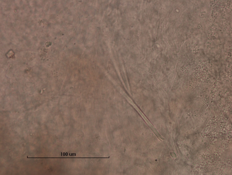Photomicrograph of part of a worm showing two modified reproductive chaetae. One is a long spear-shaped trough that comes to a sharp point. The other is a bifid chaetae with a large rounded lower tooth and a very thin upper tooth. Scale bar 100 µm.