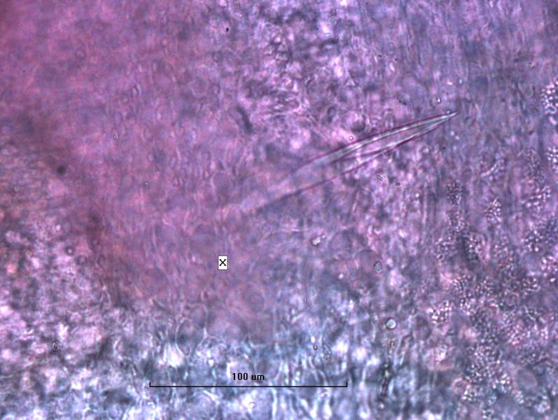 Photomicrograph of part of a worm showing a modified reproductive chaetae with a long spear-shaped trough that comes to a sharp point. Labeled X. Scale bar 100 µm.