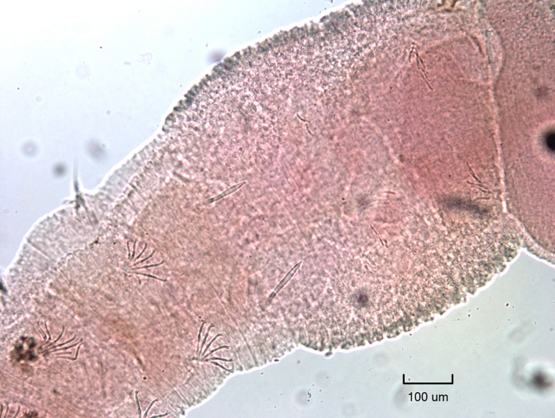 Photomicrograph of a worm showing part of the body that is thickened with a granular texture. There are two needle-like chaetae just next to this section, and other bundles of chaetae.