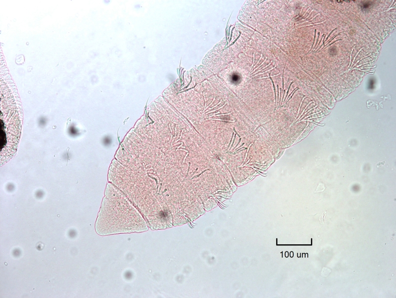 Photomicrograph of a slide mounted worm with evenly spaced bundles of chaetae. Dorsal bundles have short hairs and rounded bifid chaetae, while ventral bundles have just rounded bifid chaetae.