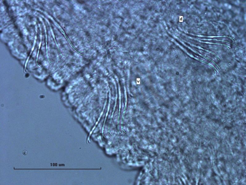 Photomicrograph of part of a worm showing several bundles of somatic hairs (chaetae). The bundles mostly have bifid chaetae with two divergent, slightly rounded teeth at the end (one labeled v), while one also has short, thin hairs (d). Scale bar 100 µm.