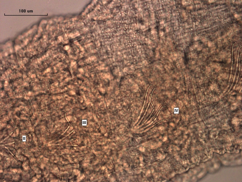 Photomicrograph of part of a worm showing a few bundles. II and III are mostly broken bifid chaetae, but III is unbroken bifid chaetae with rounded teeth and a hair chaetae.