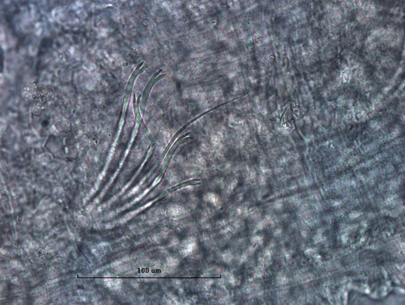 Photomicrograph of part of a worm showing a bundle of somatic hairs (chaetae). There are several bifid chatae with rounded teeth, and one short sigmoid hair. scale bar 100 µm.