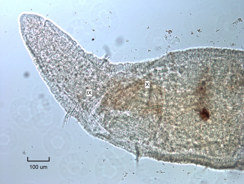 Photomicrograph of a worm with a redeveloping head evident from a smaller, thinner body lacking chaetae coming from a much thicker body. The first chaetal bundles are labeled IX and the second, labeled X, have two needle-like chaetae.