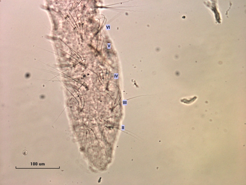 photomicrograph of the head of a freshwater oligochaete worm showing the first 6 segments, focusing on the top side of the worm. These bundles start in II, with 4-5 hairs and bifid chaetae. Scale bar 100 um.