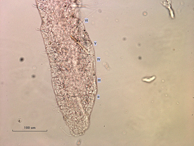 photomicrograph of the head of a freshwater oligochaete worm showing the first 6 segments, focusing on the bottom side of the worm. These bundles start in II, with 4-5 bifid chaetae. Scale bar 100 um.