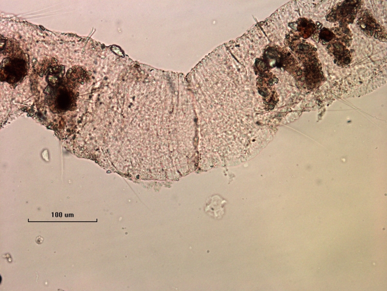 Photomicrograph of a freshwater oligochaete worm showing the joint between an adult worm and the budding attached zooid that is growing from the end. Scale bar 100 um.