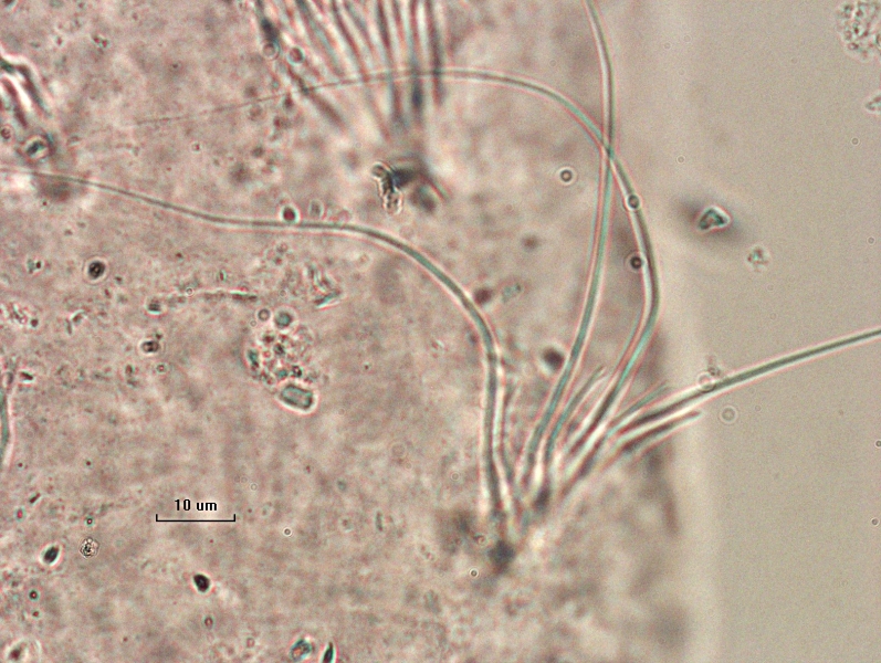 photomicrograph of part of a freshwater oligochaete worm, showing a bundle of 4 hairs and 4 bifid chaetae with long, parallel teeth. Scale bar 10 um.