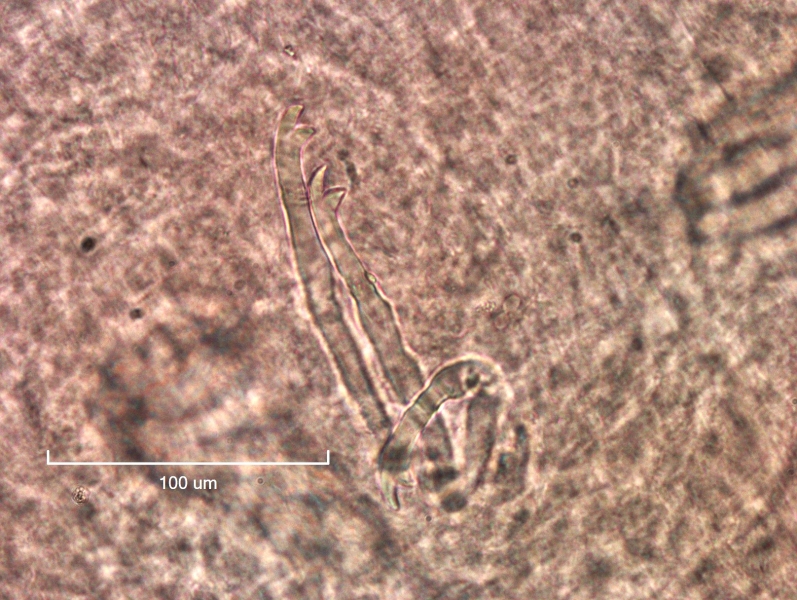 Photomicrograph of oligochaete worm features showing part of the body wall with a bundle of three bifid chaetae with upper tooth longer and a little thinner than the lower tooth. Scale bar 100um.