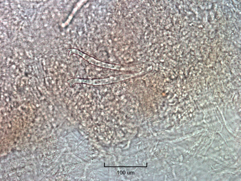 Photomicrograph of oligochaete worm features showing part of the body wall with a bundle of two bifid chaetae with upper tooth thinner and much shorter than the lower tooth. Scale bar 100um.