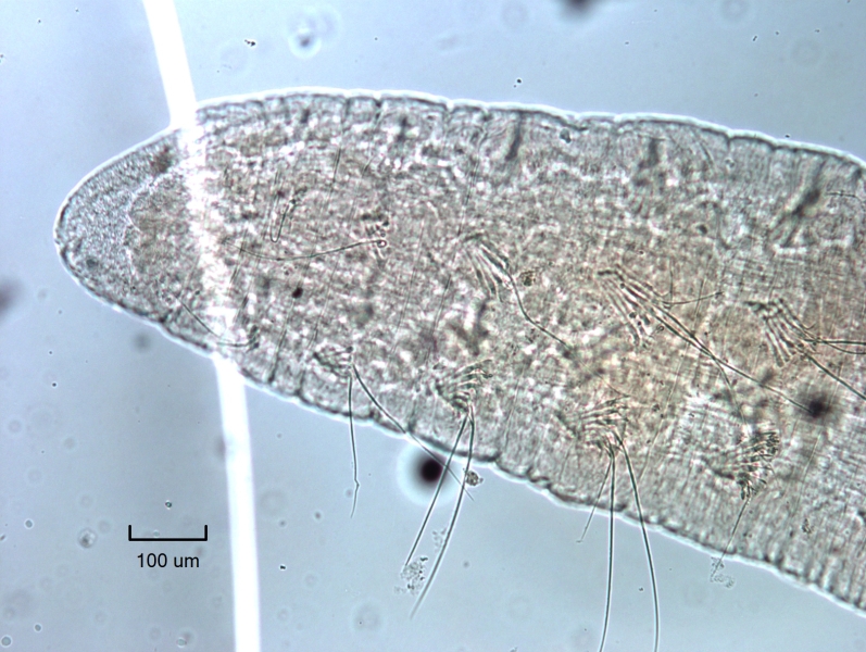 Photomicrograph of the head of an oligochaete worm with palmate chaetae and hairs, scale bar 100 microns.
