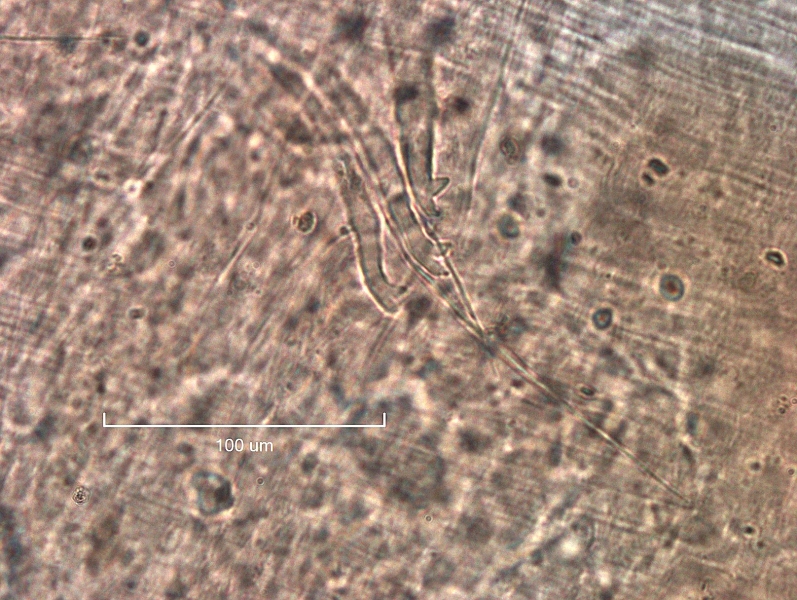 Photomicrograph of oligochaete worm features showing part of the body wall with a bundle of two thin hair chaetae and three bifid chaetae with upper tooth about the same as or shorter than the lower tooth. Scale bar 100um.