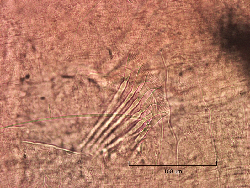 Photomicrograph of oligochaete worm features showing part of the body wall, five broadly palmate chaetae with wide fused teeth, and a long hair chaetae. Scale bar 100um.