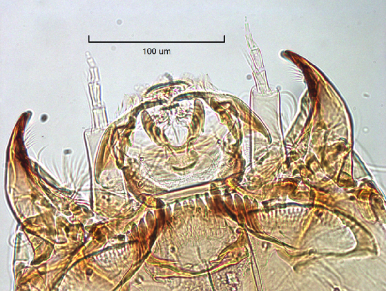 photomicrograph of the head capsule of a chironomid midge larva with antennae visible, mandibles, mentum, and striated ventromental plates.