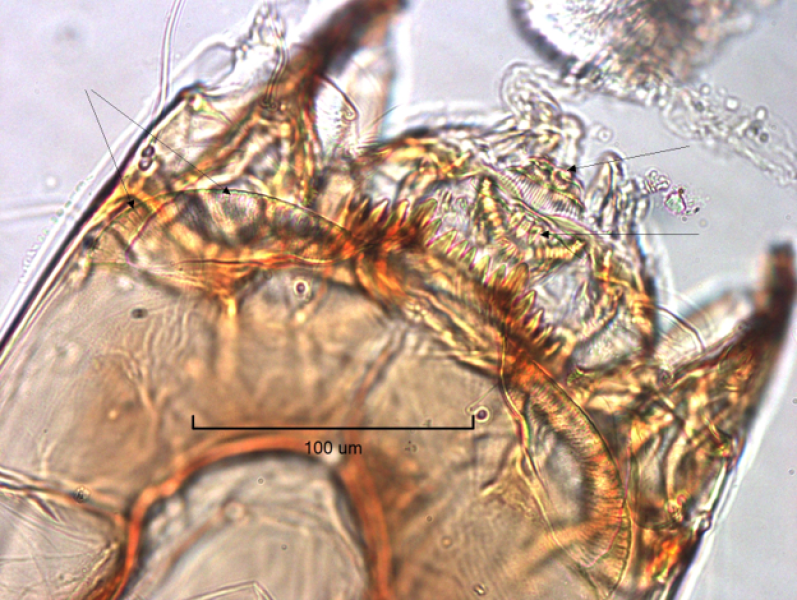 photomicrograph of the head capsule of a chironomid midge larvae showing the labrum with setae and pecten epipharyngis visible, the mentum, and the ventromental plates are visibily striated