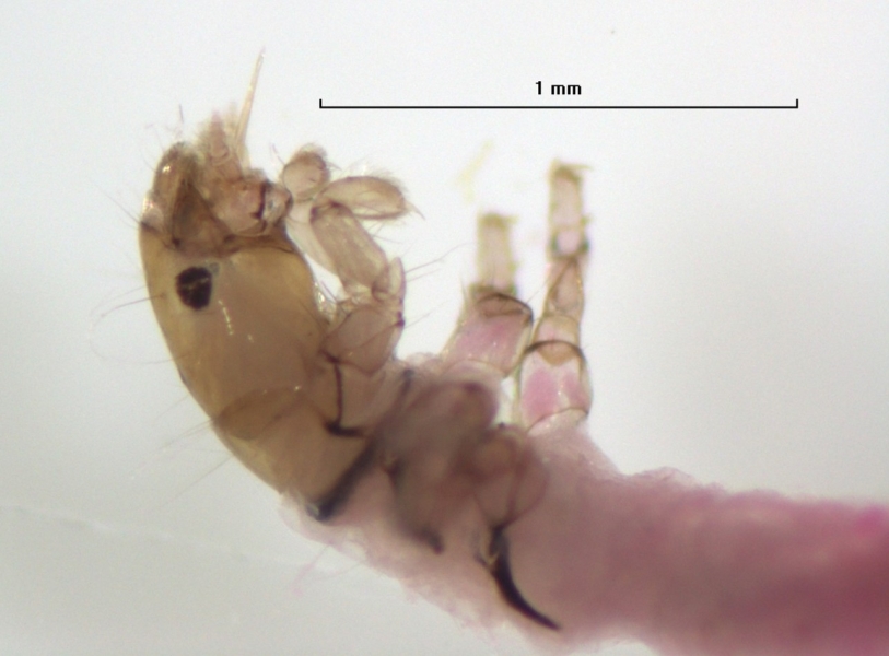 photomicrograph of the cephalothorax of a caddisfly larva with short legs with flat tarsi.
