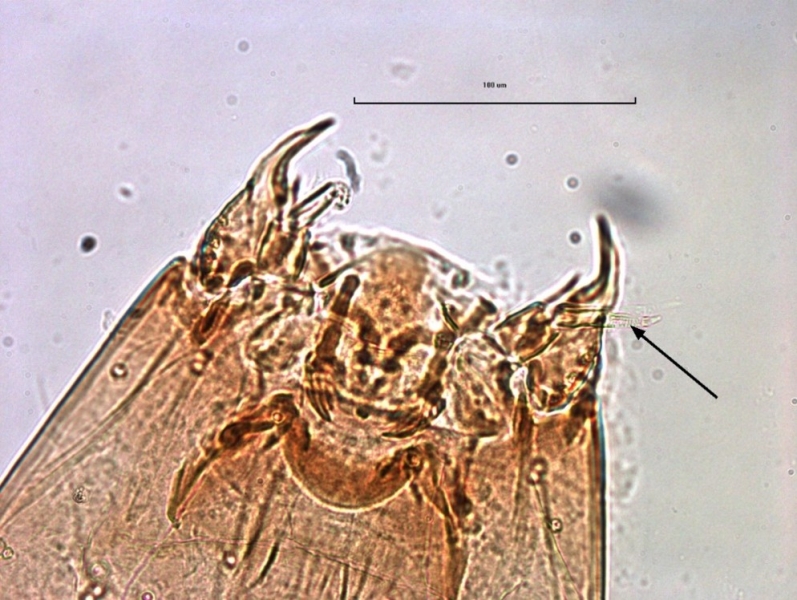 photomicrograph of the head capsule of a chironomid midge larva showing the antennae with an arrow pointing to the third segment with lines or rings on it.