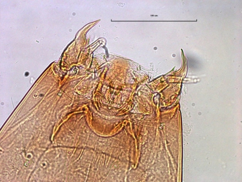 photomicrograph of the head capsule of a chironomid midge larva showing a flat mentum without teeth, mandibles, and premandibles.