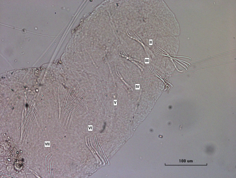 photomicrograph of the front end of a worm with segments II through VII labeled.