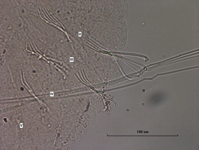 photomicrograph of part of an oligochaete worm with segments II-V labeled.The chaetae bundles have about four bifid chaetae with the upper tooth longer or almost even with the bottom tooth. Segment II and III have chaetae, IV only has chaetae on one side, and in V, chaetae are absent.